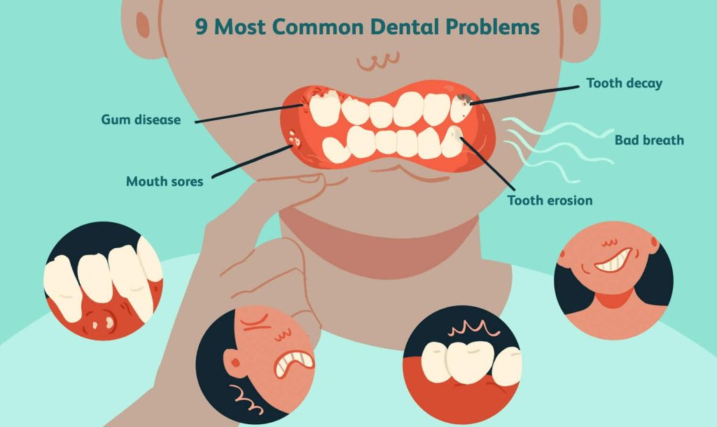A Healthy Smile: Tips to Prevent Common Dental Problems 11 Common Dental Problems