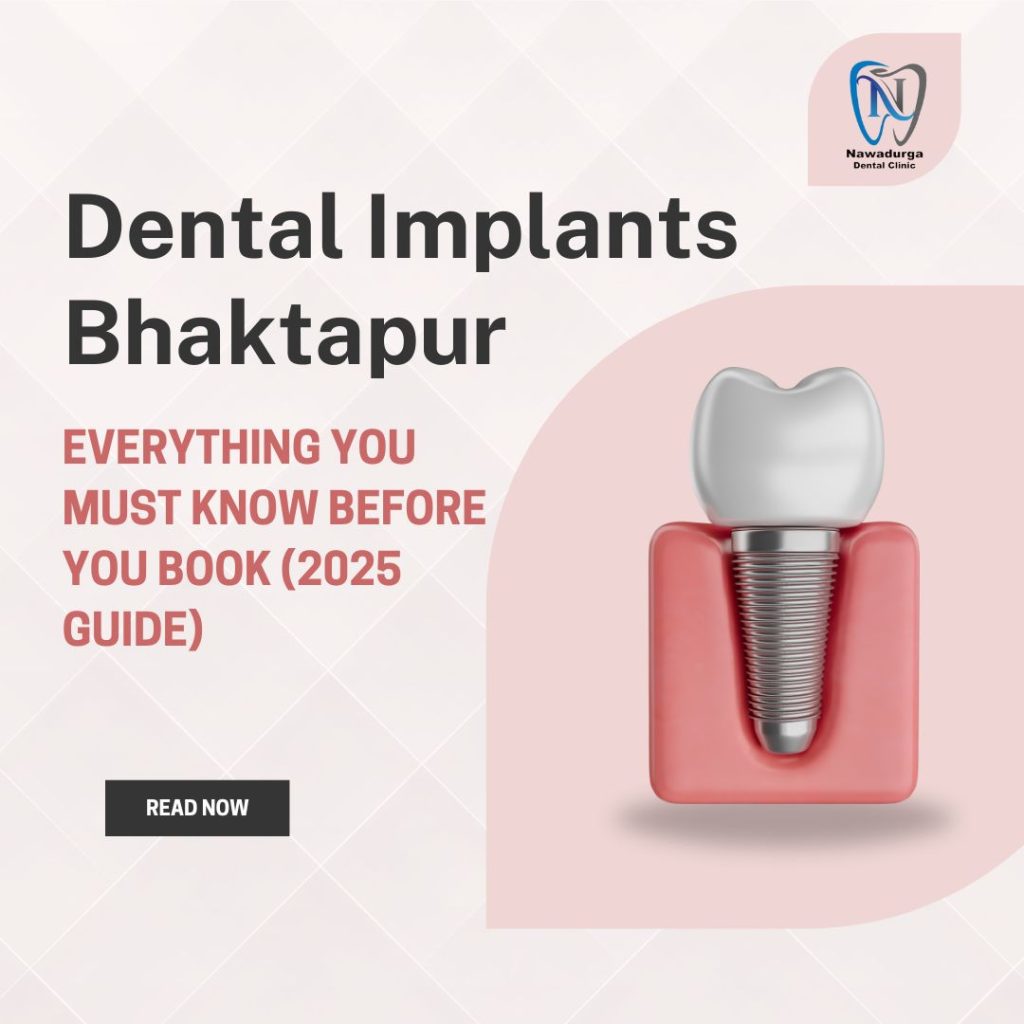 Dental Implants Bhaktapur: Everything You Must Know Before You Book (2025 Guide) 1 Light Pink and White Modern Dental Care Clinic Services Instagram Post